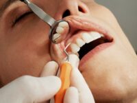 Afsløring: Kvinder er bedst til at passe på tænderne